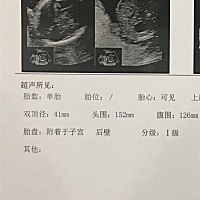 这B超单，我是真心看不懂……