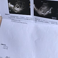 今天刚查的，宫腔分离是什么意思？这距离严重吗？