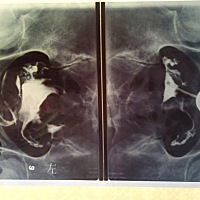 有没有懂单子的，帮忙看下单子，有问题吗？