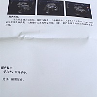 为什么还没有胚芽，卵黄囊，最后一次月经1月8号，哎是月经不规律嘛？好担心啊