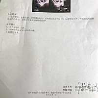 这样正常吗？大家帮忙看看