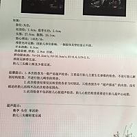 32周去检查，医生说只有29周大小，有什么影响