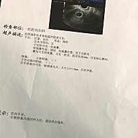 男宝还是女宝？