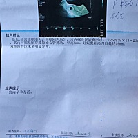 亲们，孕7周，能看出男女宝宝吗😘😘都有胎芽了