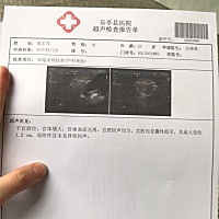 仅供参考：2月10号排卵，19号晚上测出来微微粉（很淡很淡），22抽血hcg68，今天查的hcg和孕酮（见报告单...