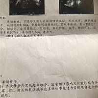 宝宝马上出生了。特别好奇是男宝还是女宝。我婆婆和我老公都喜欢女宝。我希望也是个女宝