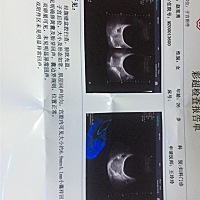 两个彩超之间相差8天，长大这些正常吗，hcg比两天前才涨了一千多，这样能保住宝宝吗，怀个孕天天提心吊...