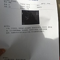 谁能帮忙看下男孩女孩，第一胎男孩，这个是女孩最好，家里全部都是男孩。谢谢大家