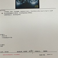 医生说能看见胚芽，但是在里面没有动，有可能在里面死掉，要不然就会流产，各位亲帮忙解释一下！