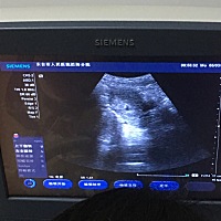 41天去做了B超，医生没给开单子让我一周后再来给我好好看一下，现在只看到宫内有个小暗区，这是啥意思，...