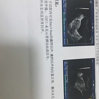 末次月经1.21号，今天第一次做检查，医生说还没有看到胚胎，让一周之后复查，没有姐妹有类似的经验，求...