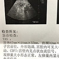 今天一天腰疼，去做了B超，医生说没事多休息，宝宝好棒，健康成长啊，爱你，给老妈看，妈妈说像女孩，希...