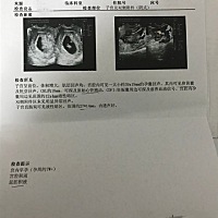 有没有看懂的，我怀的到底是男的还是女的，好好奇吖