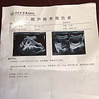 男宝还是女宝有没有会看的呀！谢谢