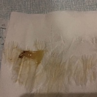 38 刚刚去厕所有这个，要不要去医院？？有知道的吗？你们要生了都是什么症状？？