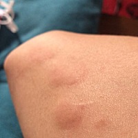 孕妇这样是怎么回事孕妇这样是怎么回事