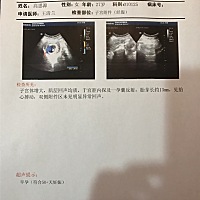 这样能看出性别吗？没查孕酮、这单子能看出来有无异常吗？