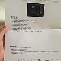 有会看BB超单的吗？