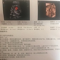 想知道是男宝还是女宝，求解答