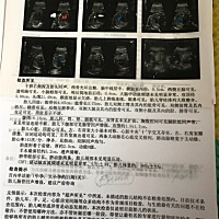 快出生了，比较好奇是男宝宝还是女宝宝，谁会看的帮忙看下，谢谢了