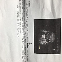 老婆5个多月了，请大神鉴定是男宝还是女宝😚