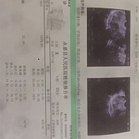 5周＋2今天去医院拿了验血结果和B超.对了今天做的是阴超     会不会对有影响啊      问了医生说没关系  ...