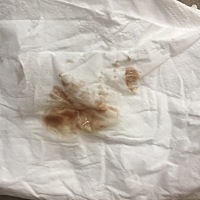 什么情况，肚子也不疼，急……