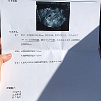 怀孕七周检查结果，大夫说挺好的，就是不知道还要多久能有胚芽和原始心血管搏动