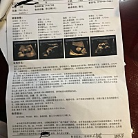 麻烦帮我看哈系统B超 谢谢大家哟！