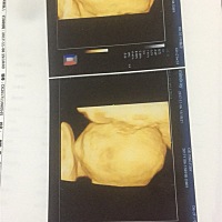 谁会看男女，还有三天就去破腹产了。