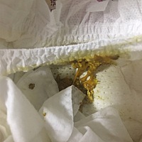 宝宝的粑粑正常嘛？