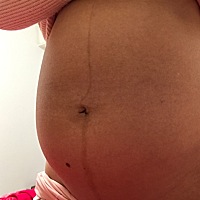 35 6的肚子，肚子皮肤越来越黑，美颜都没用，所以直接上原图。咋回事？