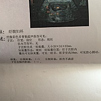 请问谁能看出来宝宝多少周吗？谢谢