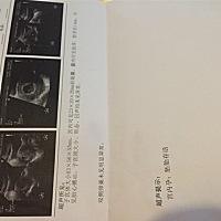 宝宝很乖👍👍👍👍