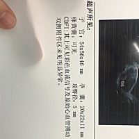 大家帮忙看一下，男孩女孩？