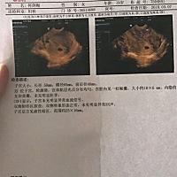 亲们，帮我看看，这是不是属于正常，