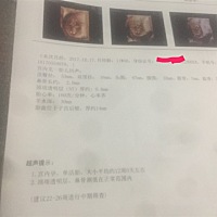 11周做了nt，医生说正常，没啥问题，等着做唐筛了。南昌私立医院检查的，198元普通的，信息就报告里的这...