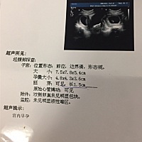 怀孕9周多有懂的吗，是男是女