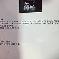 我这个属于圆的吧