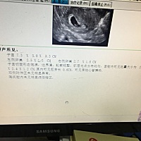 哪位有经验的宝妈能看出是男是女