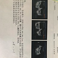 孕7周，做B超发现附件囊肿，医生让观察，等12周的时候第一次孕检再看。很难过