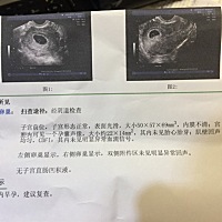 怀孕44天，未见胎心，请问各位亲这样正不正常呢？