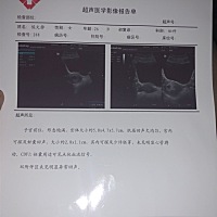 怀孕第八周 今天去看孕酮 10.65 医生说低 然后让我做了个b超 显示胎芽许少 未见明显胎心 ，医生说让我有...