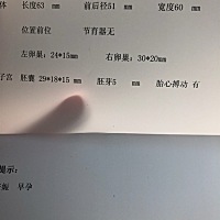 50天 第一次做的腹超 已经有胎心了哟 希望宝贝健康成长 会看男孩女孩的帮忙看看呀 纯粹好奇 男孩女孩都...