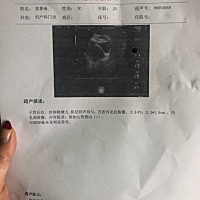 宝妈们看下，这个正常吗，最近下面有点黄黄的东西，今天第一次看见胎心好激动，3月1号去查只有孕囊