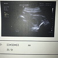 谁能帮我看看男女呀