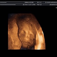 看看是男还是女宝