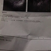 女友怀孕54去医院检查胎胚停孕，医生也建议超过了7mm就不必要再复诊检查心跳了，好不甘心