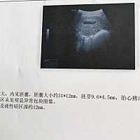 纯属无聊 猜男女👫👫