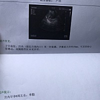 有怀孕接近宫颈内口的宝妈吗？好着急啊，该怎么办？